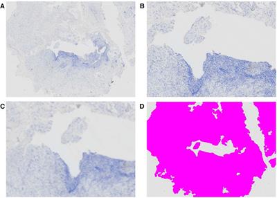 Standardized protocol for quantification of nerve bundle density as a biomarker for endometriosis